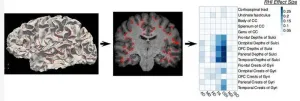 Soccer heading damages brain regions affected in CTE