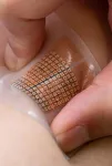 Soft skin patch could provide early warning for strokes, heart attacks