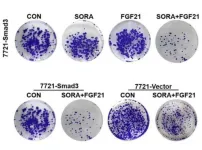 SORA combined with FGF21 can inhibit the growth and promote apoptosis of HCC cells through Smad3