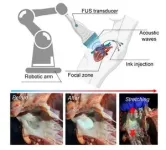 Soundwaves harden 3D-printed treatments in deep tissues 2