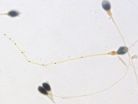 Sperm length variation is not a good sign for fertility