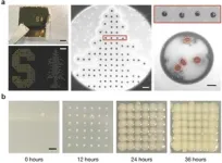 Stanford researchers develop a new way to identify bacteria in fluids 2