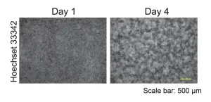 Starvation and adhesion drive formation of keratinocyte patterns in skin