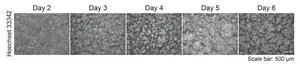 Starvation and adhesion drive formation of keratinocyte patterns in skin 2