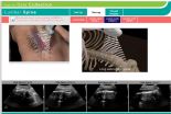 Station Spinal Ultrasounds Seeking Why Astronauts Grow Taller in Space 3