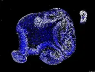 Stem cell model of human brain development suggests embryonic origins of Alzheimer’s disease