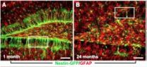 Stem cell-related changes that may contribute to age-related cognitive decline identified