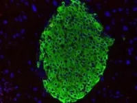 Stem cells shed insight into cardiovascular disease processes  2