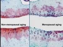 Study identifies mechanism underlying increased osteoarthritis risk in postmenopausal females