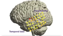 Study maps new brain regions behind intended speech 2