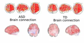 Study proposes use of artificial intelligence to diagnose autism spectrum disorder