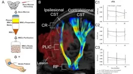 Study provides evidence that bone marrow cell injections help heal the brain after stroke