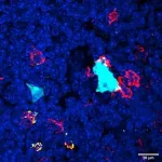 Study reports discovery of new cell type in thymus 2