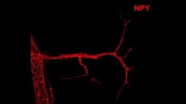 Study reveals new factor involved in controlling calorie expenditure