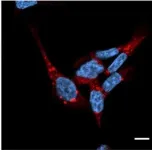 Study reveals novel therapeutic target to eliminate unwanted and misfolded proteins 2