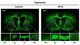 Study reveals ways in which 40Hz sensory stimulation may preserve brain’s ‘white matter’