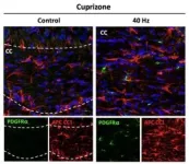 Study reveals ways in which 40Hz sensory stimulation may preserve brain’s ‘white matter’ 2