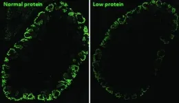 Study shows how low-protein intake during pregnancy can cause renal problems in offspring