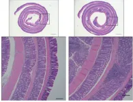 Study to decode microbe-gut signaling suggests potential new treatment for IBD