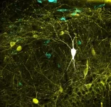 Study upgrades one of the largest databases of neuronal types