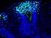 Studying herpes encephalitis with mini-brains