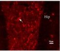 Substance P in hippocampus versus striatal marginal division for learning/memory function