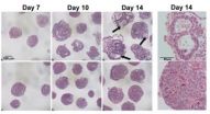 Successful stem cell differentiation requires DNA compaction, study finds