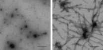 SUMO defeats protein aggregates that typify Parkinson’s disease