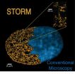 Super-resolution microscopes reveal the link between genome packaging and cell pluripotency 2