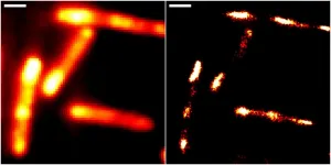 Super-resolution RNA imaging in live cells