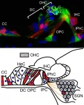 Superoxide produced in the cochlea of inner ears causes acquired hearing loss