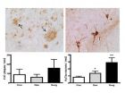 Surgery more profound effect than anesthesia on brain pathology, cognition in Alzheimer's mice