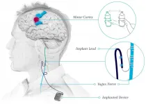 Surgical procedure may help restore hand and arm function after stroke