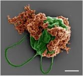 Swimming microrobots deliver cancer-fighting drugs to metastatic lung tumors in mice