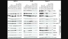 Synergistic cytotoxicity of HDAC and PARP inhibitors and decitabine in pancreatic cancer cells: implications for novel therapy