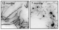 Tangled path of Alzheimer's-linked brain cells mapped in mice 2