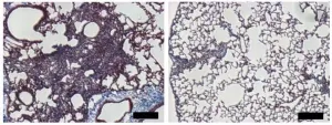 Targeting mechanosensitive protein could treat pulmonary fibrosis, study suggests