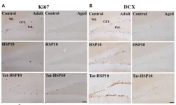 Tat-heat shock protein 10 ameliorates age-related phenotypes in the hippocampus