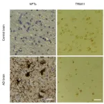 Tau-regulating protein identified as a promising target for developing Alzheimer’s disease treatment