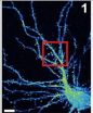 Team explains how mutated X-linked mental retardation protein impairs neuron function