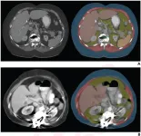 Technical adequacy of artificial intelligence body composition assessed in external CT