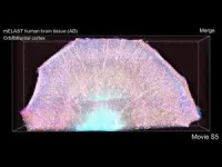 Technologies enable 3D imaging of whole human brain hemispheres at subcellular resolution 2