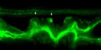 Tension on gut muscles induces cell invasion in zebrafish intestine, mimicking cancer metastasis