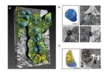 The gut-brain connection in Alzheimer’s unveiled with X-rays 2