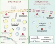 The importance of a disturbed lipid metabolism in Charcot-Marie-Tooth disease 2