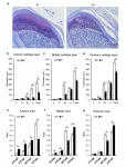 The jaws of life - how hypoxia exposure affects jaw cartilage growth