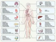 The mechanism of ferroptosis and its related diseases 2