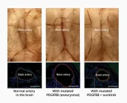 The mutant origin of brain aneurysms and the first drug treatment