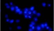 The Pael-R gene does not mediate the changes in rotenone-induced PD model cells