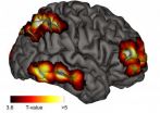 The seat of meta-consciousness in the brain